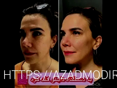 بهترین دکتر هایفو نی نی سایت